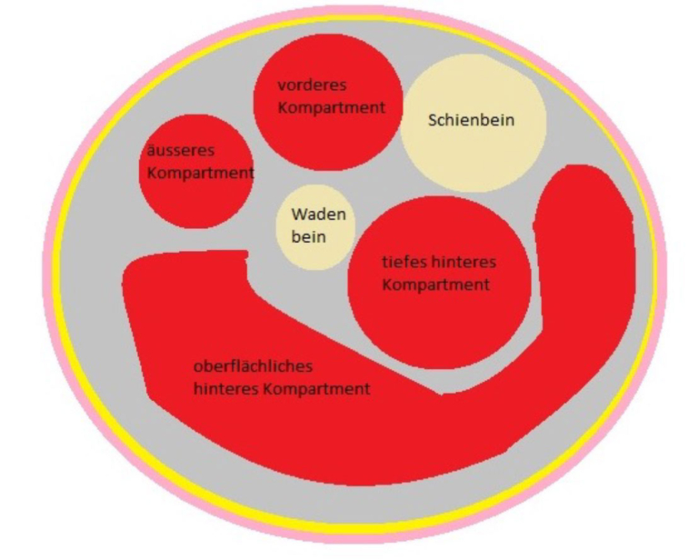 Kompartmentsyndrom Wie Lange Dauert Die Heilung www.altius.ag